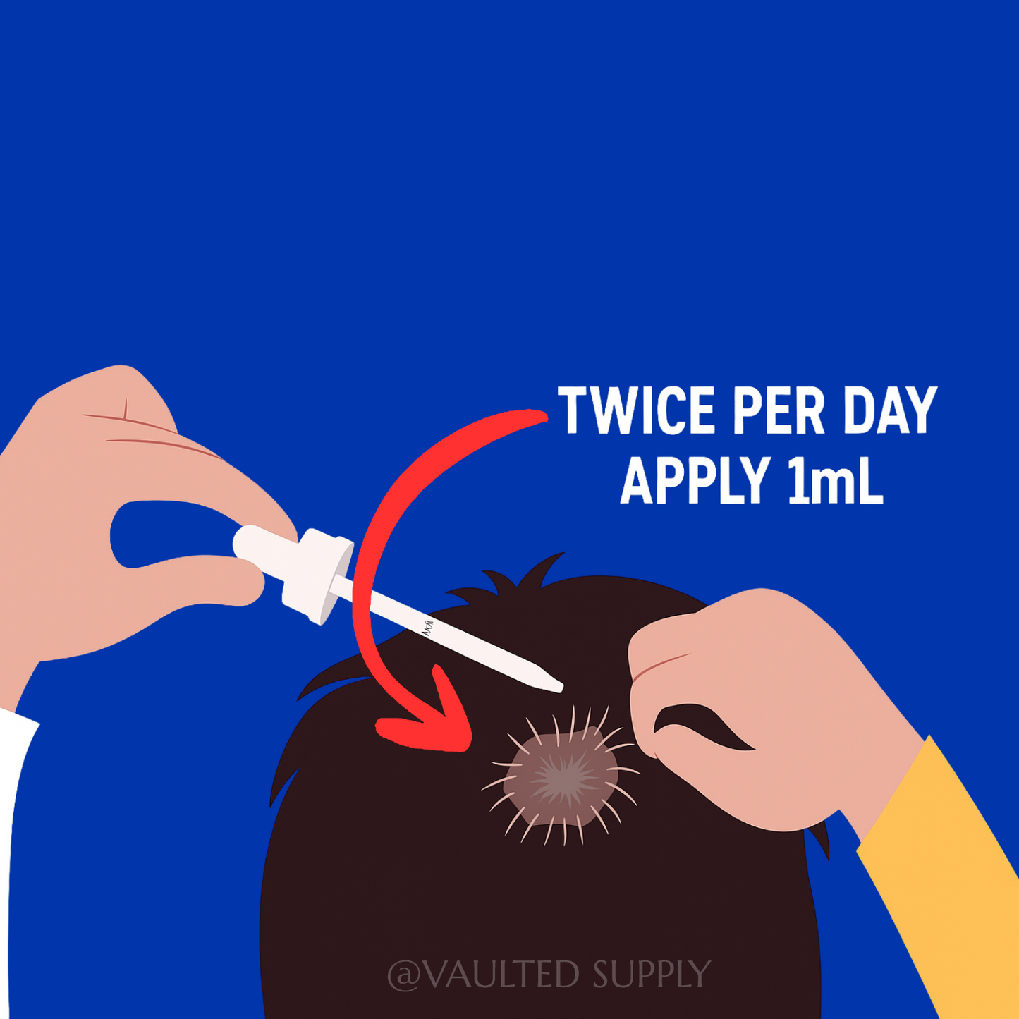 Kirkland Signature Minoxidil 5% Extra Strength for Men Hair Regrowth 6 Boxes